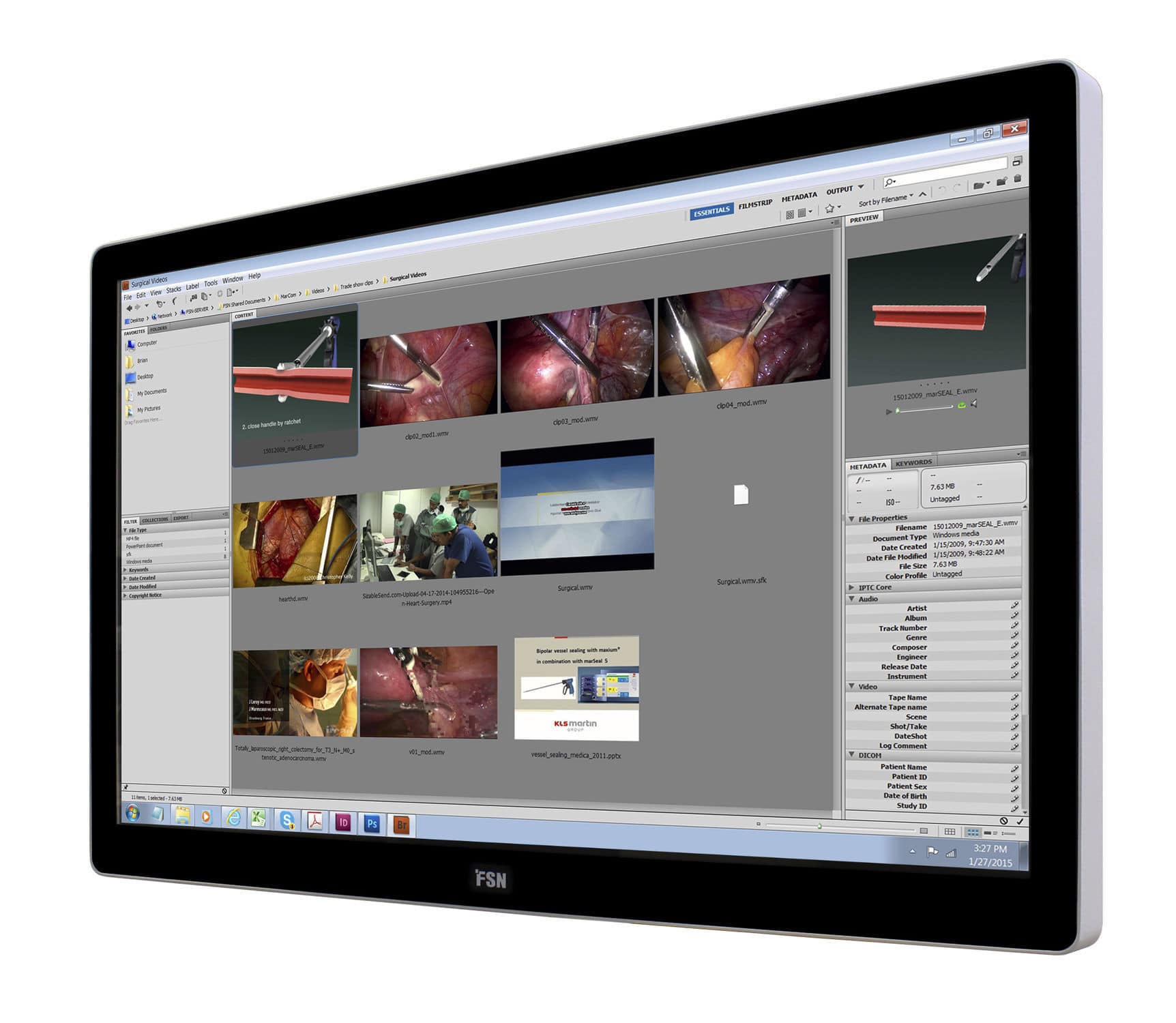 Медицинский монитор FSN 4К (UHD), 55" (DVI-D)
