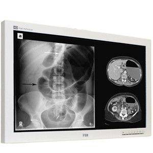 Медицинский монитор FSN 4К (UHD), 31", 4xSDI