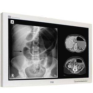 Медицинский монитор FSN 46" Full HD, c сенсорным экраном